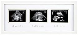 Pearhead Triple Sonogram Pregnancy Keepsake Frame, Watch Baby Grow Through all Three Trimesters - Great Gift For Expecting Parents, White