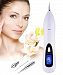 Freckle Mole Removal Pen, Hkim Portable USB Charging Dot Dark Spot Skin Tag and Tattoo Remover Beauty Skin Machine (Style 3)